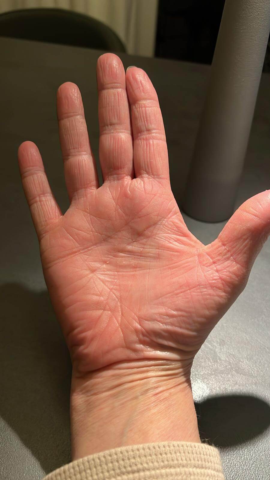 Neurodermitis nachhaltig geheilt November 2025 keine Rückfälle Neurodermitis nachhaltig geheilt November 2025 - keine Rückfälle